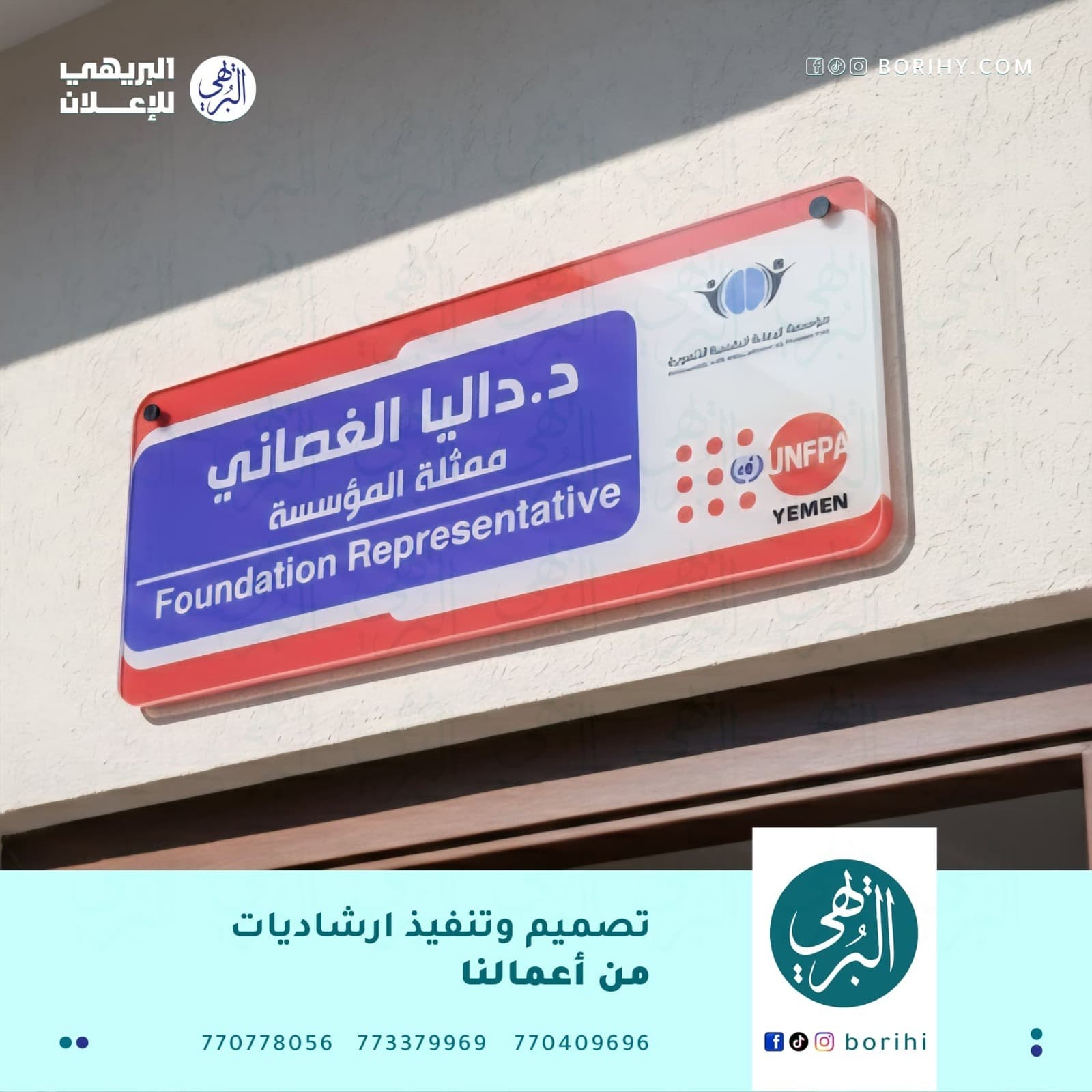 طباعة UV ناقل بارز ورق A3